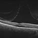 Томограф офтальмологический трехмерный оптический когерентный DRI OCT –TRITON plus